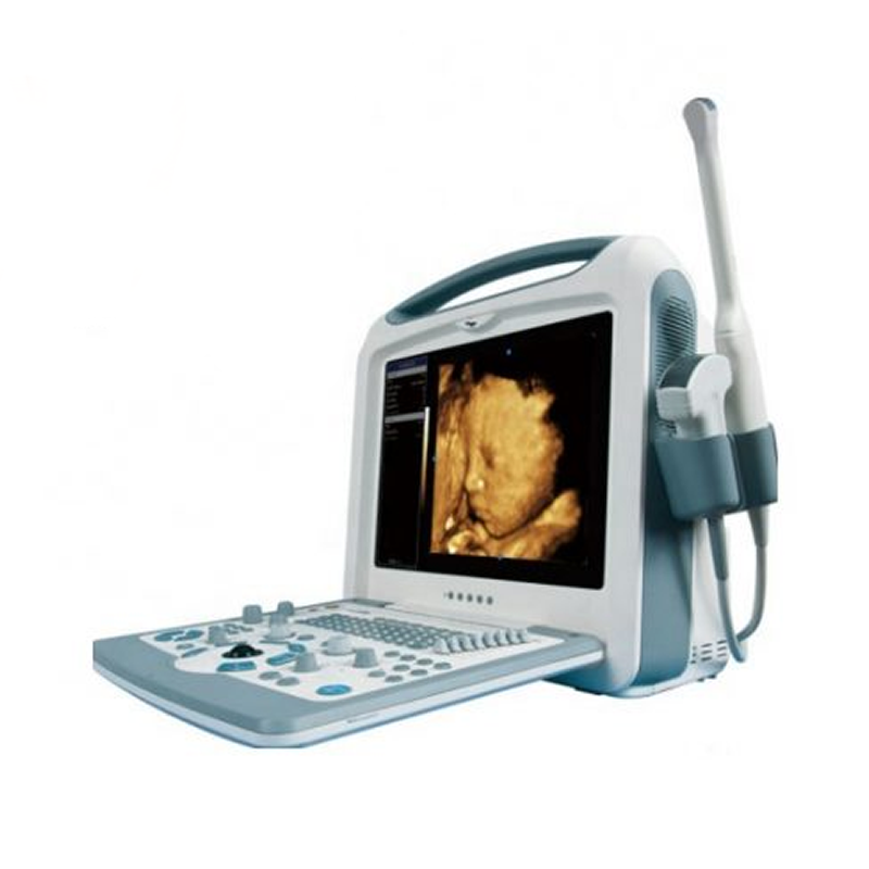 Scannere cu ultrasunete